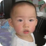 幼儿急疹常识